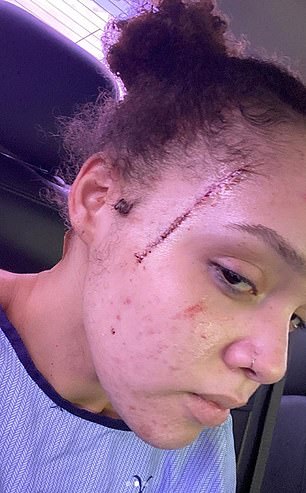 En la imagen: algunas de las lesiones sufridas por Yasmine en el presunto ataque
