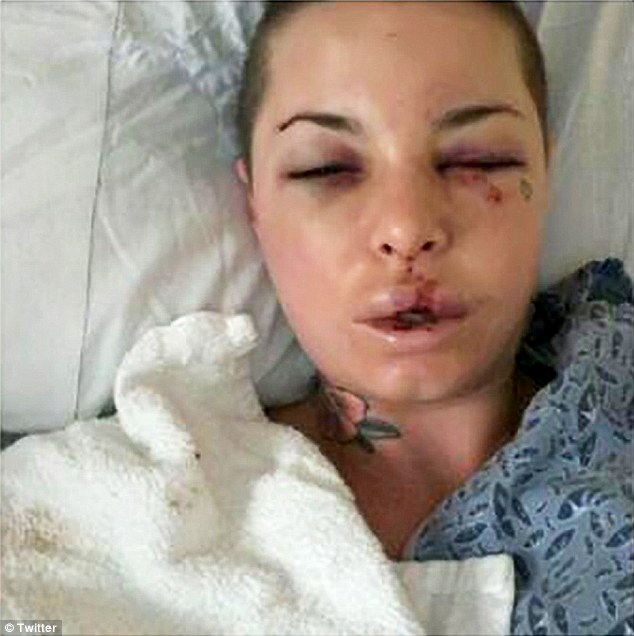 Mack fue golpeada tan brutalmente que no tenía dientes cuando la policía la encontró. 