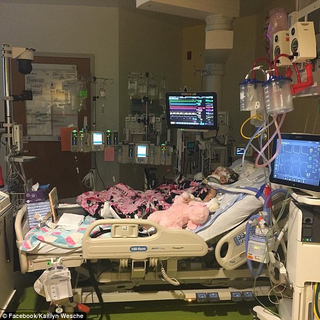 Aferrándose a la vida: esta foto tomada en el Centro Médico del Hospital Infantil de Cincinnati muestra a Hannah conectada a monitores y máquinas 