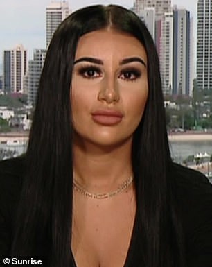 Mikaela, que no es ajena a los inyectables cosméticos, recibió previamente rellenos de labios y un estiramiento de cejas con Botox, lo cual admitió en TikTok.  Aquí: 2019